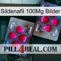 Sildenafil 100Mg Images 15